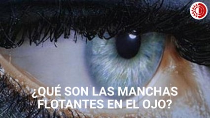¿Qué son las manchas flotantes en el ojo?
