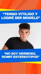 ¿Daniel Ruenes presentó problemas en su carrera como actor y modelo por su vitiligo?