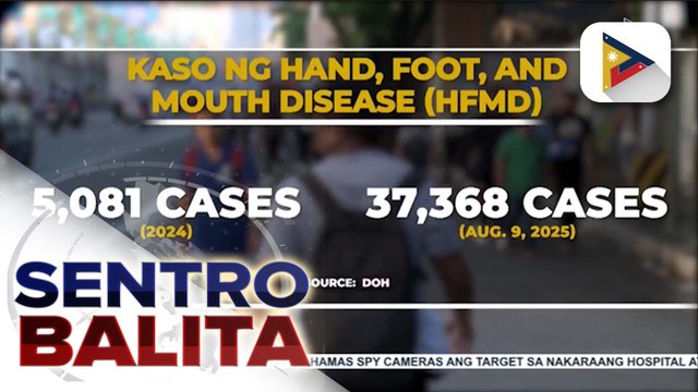DOH, pinag-iingat ang publiko sa banta ng hand, foot, and mouth disease ngayong panahon ng tag-ulan | ulat ni Bien Manalo