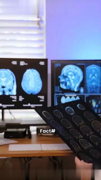 Unlock Your Brain’s Potential: Boost Focus, Memory & Creativity