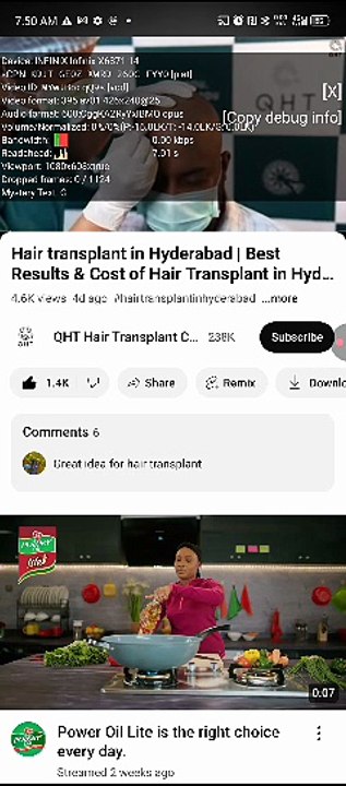 Hair transplant in Hyderabad | Best Results & Cost of Hair Transplant in Hyderabad