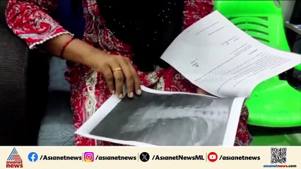 ശസ്ത്രക്രിയയിൽ ഗുരുതര വീഴ്‌ച; ഗൈഡ് വയർ യുവതിയുടെ നെഞ്ചിൽ കുടുങ്ങി; പിഴവ് സമ്മതിച്ച് ഡോക്ടർ