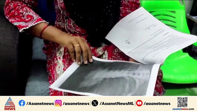 ശസ്ത്രക്രിയയിൽ ഗുരുതര വീഴ്‌ച; ഗൈഡ് വയർ യുവതിയുടെ നെഞ്ചിൽ കുടുങ്ങി; പിഴവ് സമ്മതിച്ച് ഡോക്ടർ