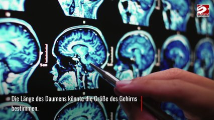 Wissenschaftler finden Zusammenhang zwischen Daumenlänge und Gehirngröße