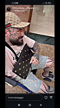 1727 wrldstar operato d'ernia