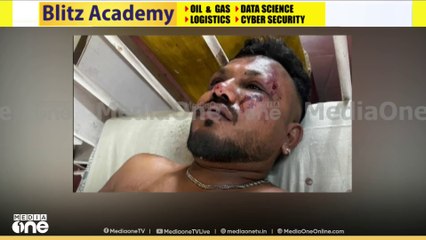 അഹമ്മദാബാദ് അപകടം; രക്ഷപ്പെട്ടത് വിശ്വാസ് കുമാർ രമേശ്