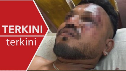 [TERKINI] Seorang penumpang terselamat  - Komisioner polis