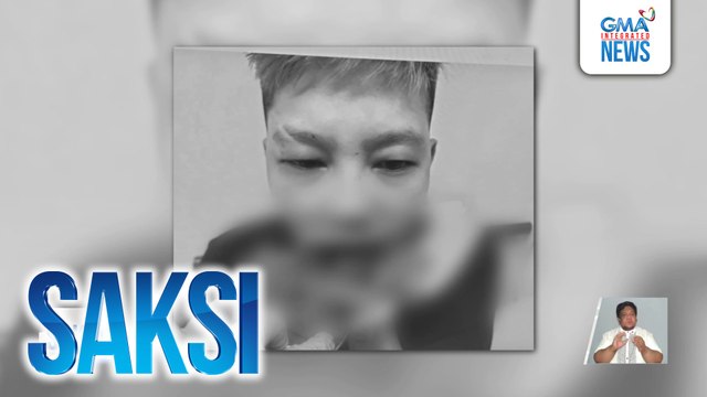 Babaeng sinamahan lang ang kanyang pinsan, tinaga sa mukha; 16-anyos na pinsan, tinangka rin umanong tagain ng suspek | Saksi