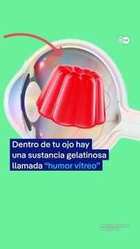 ¿Qué son las manchas flotantes en el ojo?