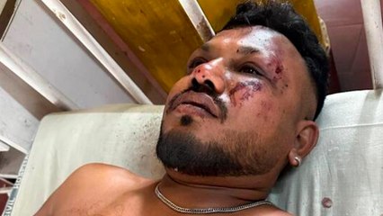 Ramesh, el milagro del superviviente del asiento 11A del avión estrellado en India