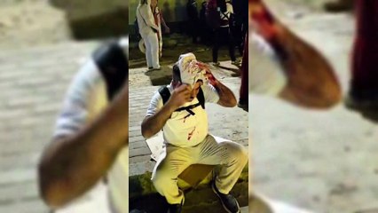 Mısır’da HÜDA Par Milletvekili Faruk Dinç’e saldırı: Feci şekilde yaralandı