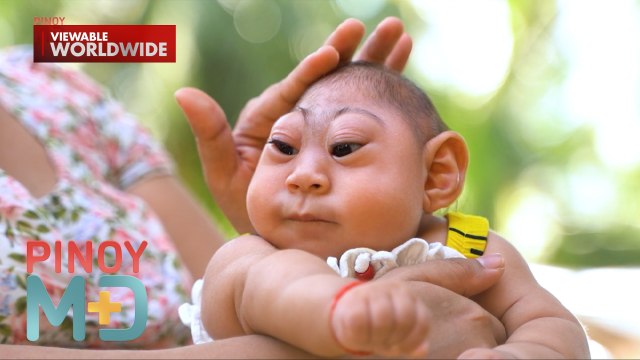 Sanggol, ipinanganak na maliit ang ulo o may kondisyong microcephaly | Pinoy MD
