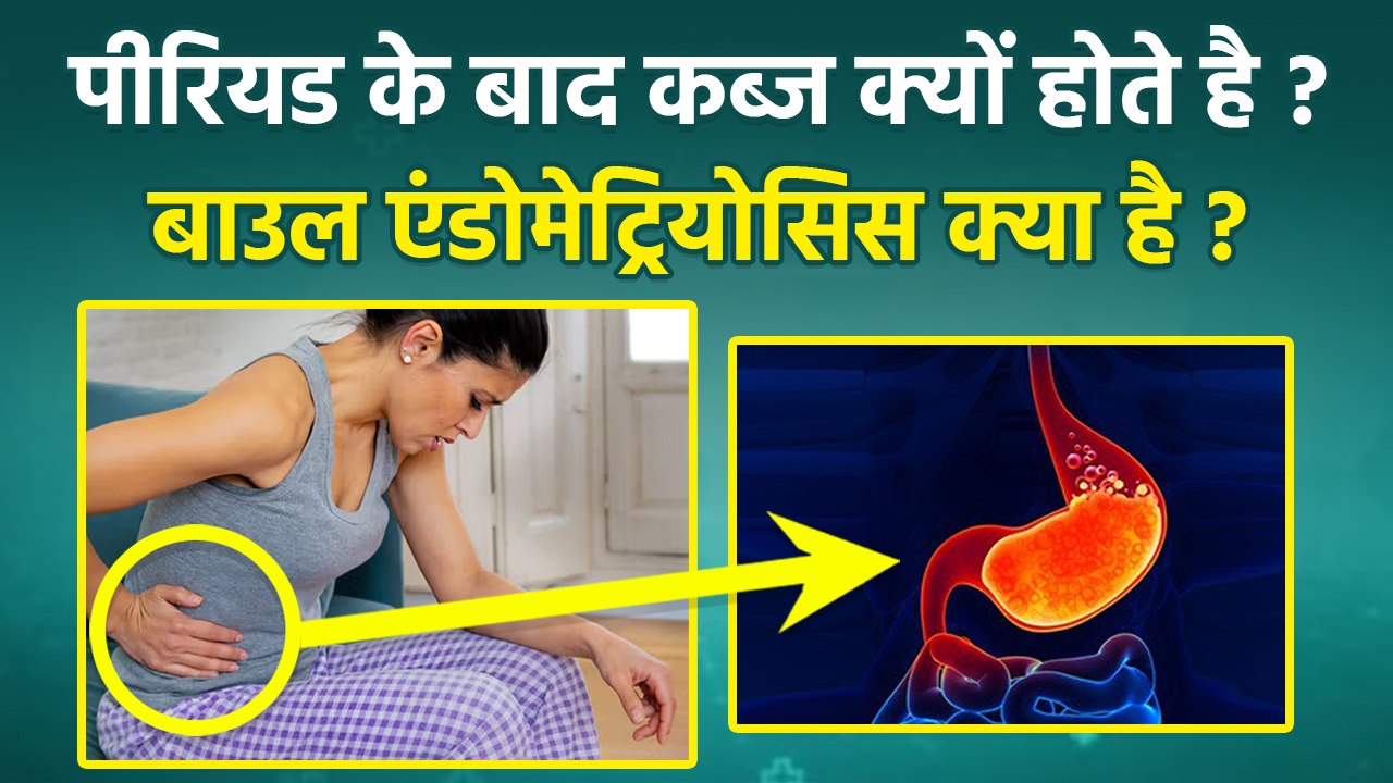 Period Constipation: पीरियड के बाद कब्ज क्यों होते है, Bowel Endometriosis Symptoms & Treatment...