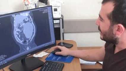 Karın ağrısı şikayeti bulunan hastanın böbreğinden 23 santimetrelik kist çıkarıldı