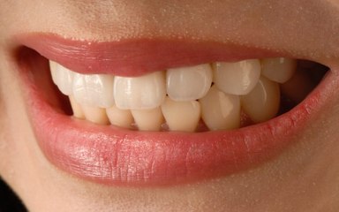 Oui, vos DENTS sont importantes !