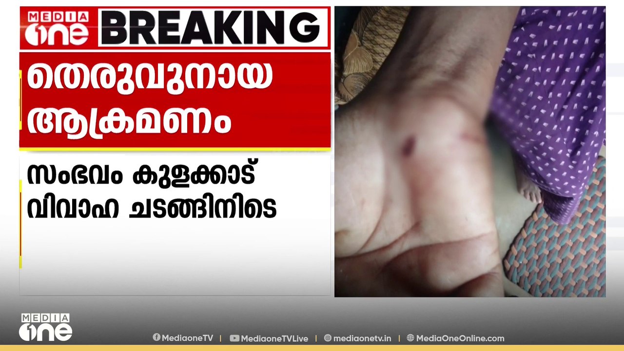 ആറു പേർക്ക് തെരുവുനായയുടെ കടിയേറ്റു; ആക്രമണം വി...