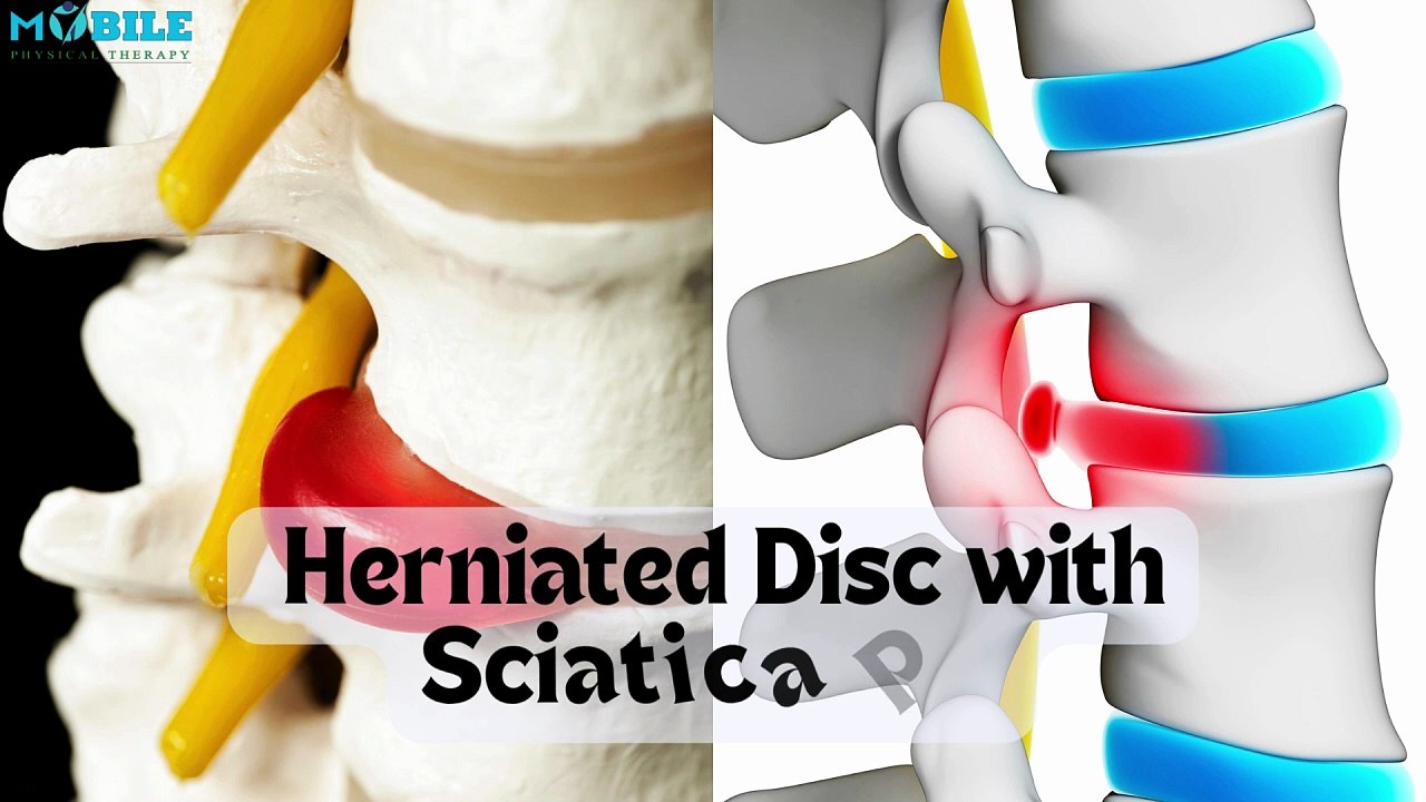 11 Best Exercises for Herniated Disc & Sciatica Pain Relief | Step-by-Step Guide