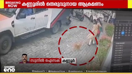 കണ്ണൂർ നഗരത്തിൽ നിരവധി പേരെ കടിച്ച തെരുവുനായ ചത്ത നിലയിൽ