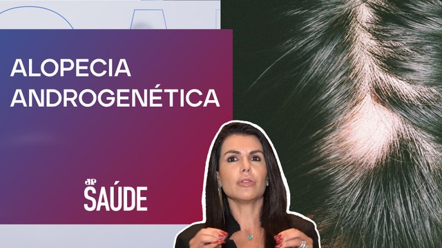 Quais são as causas da calvície? | Dra. Ana Carina