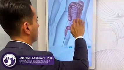 Dr. Mikhail Yakubov | New York Gastroenterologist