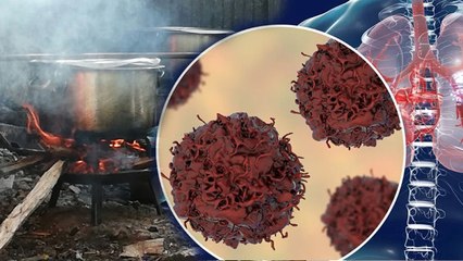 Kitchen Smoke Cause Cancer:गैस‑स्टोव से निकलने वाले जहरीले गैस,Benzene से बढ़ सकता है कैंसर जोखिम...