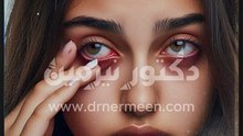 علاج تورم العين في المنزل viral #viralvide # #صحة #صحية #علاج #العين #تورم #عين #العيون