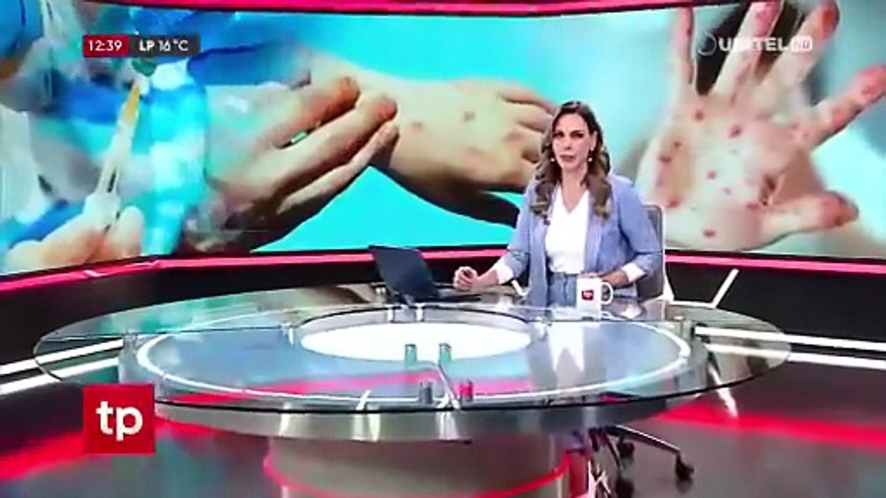 Sarampión: Suben a 49 los casos confirmados en Santa Cruz y existen 369 sospechosos, según el Sedes