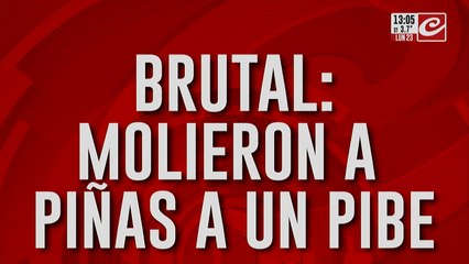 Molieron a piñas a un pibe: le fracturaron la mandíbula y la nariz