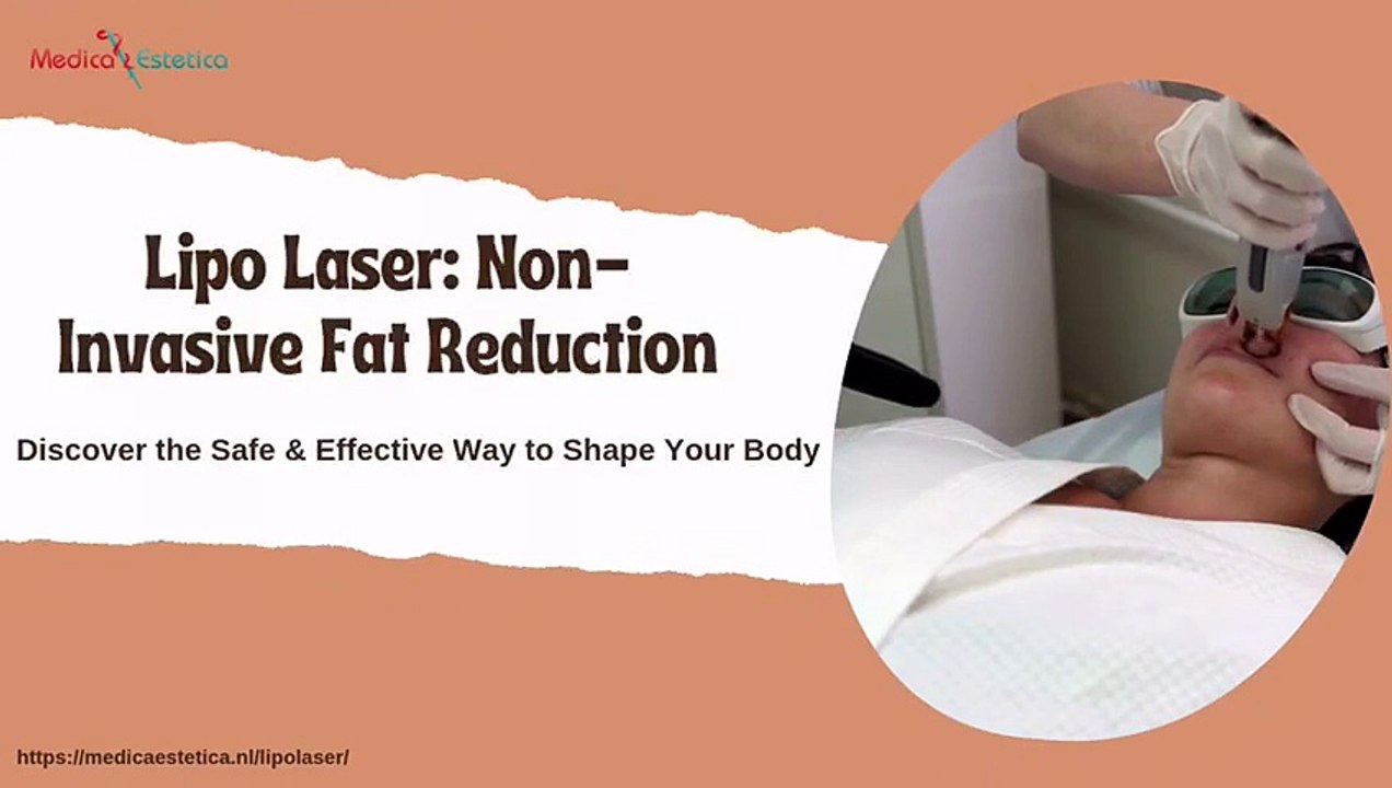 Lipo Laser: Non-Invasive Fat Reduction