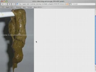 Dr. Natura Colonix Colon Cleanse Program - Day 37