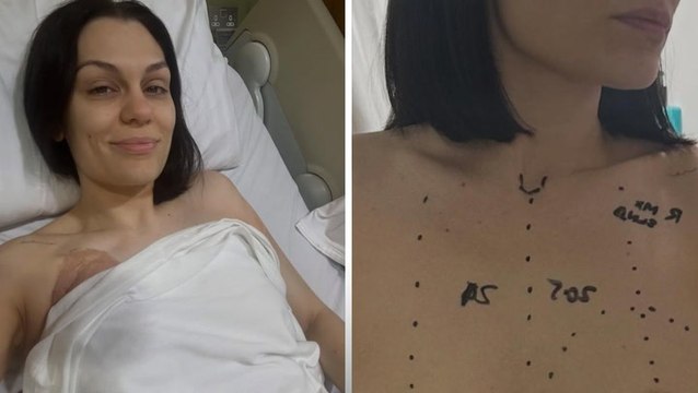 Jessie J shares tearful update after undergoing breast cancer surgery