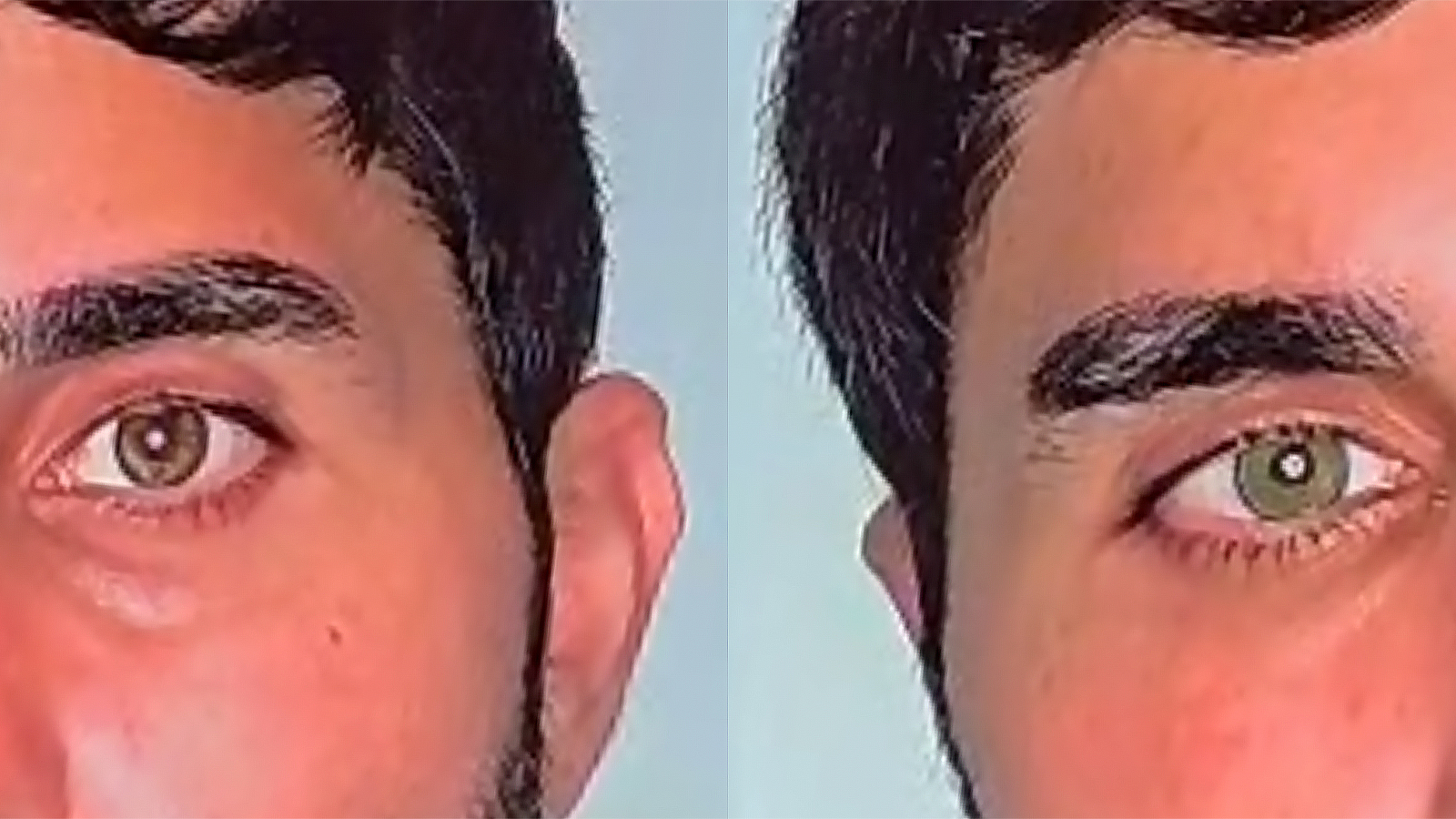 Göz rengini kalıcı olarak değiştirmek mümkün; en çok mavi ve yeşil ...