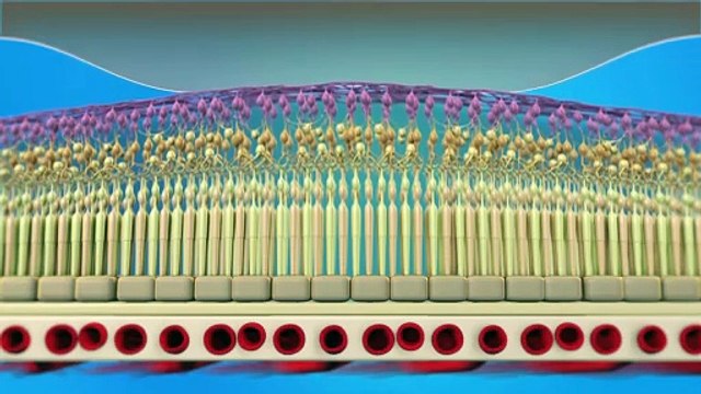 Vitreomacular Traction & Macular Holes