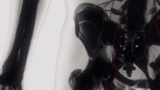 In aumento interventi di protesi d’anca anche per i più giovani