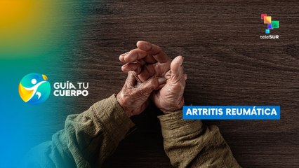 Artritis reumática