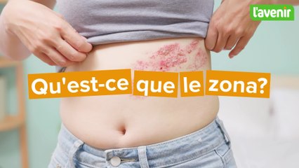 Sante / qu'est-ce que le zona ?