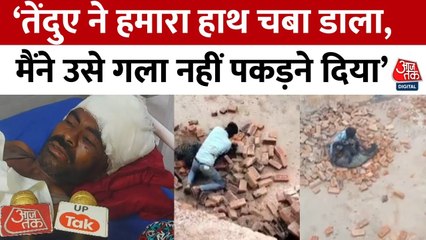 लखीमपुर खीरी के युवक की तेंदुए से न‍िहत्थे भ‍िड़ने के बाद भी कैसे बची जान, खुद उस से जानें