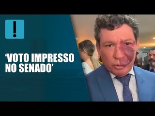 "É bem capaz de eles pedirem voto impresso no Senado", diz Reginaldo Lopes sobre bolsonaristas