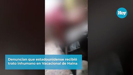 Denuncian que estadounidense recibió trato inhumano en Vacacional de Haina