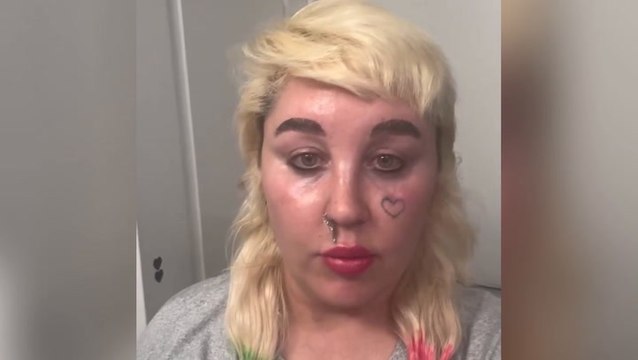 Amanda Bynes reveals she is taking Ozempic to ‘look better in paparazzi pictures’ in rare life update