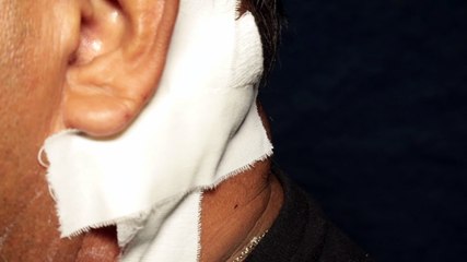 Funcionário público reage a assalto em ônibus, é esfaqueado, mas polícia persegue e prende o criminoso