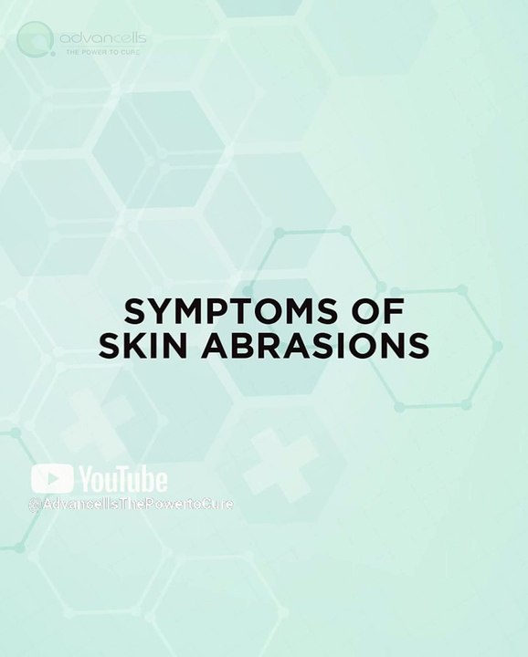 Symptoms of Skin Abrasions | #Advancells #StemCellTherapy