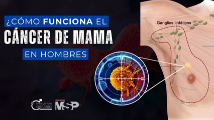 Cómo funciona el cáncer de mama en hombres