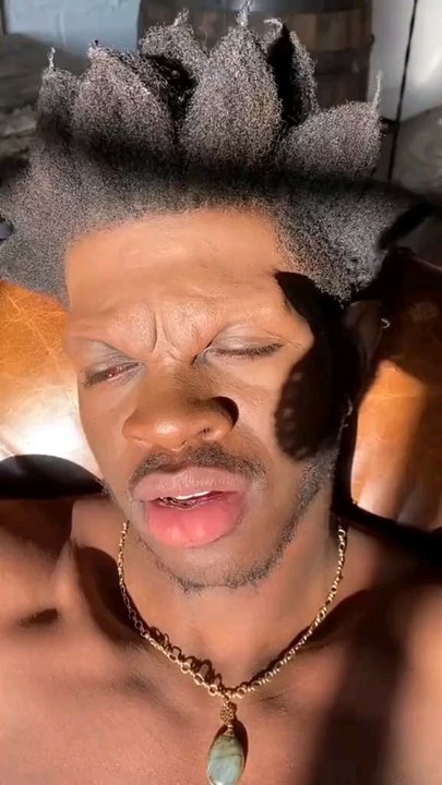 Lil nasx souffre d'une paralysie du visage