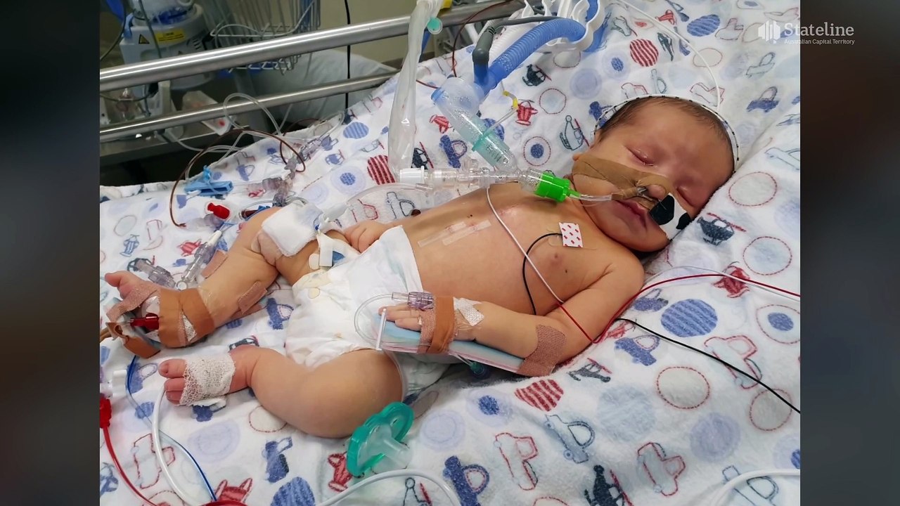 Looming price changes to national disability insurance worry providers