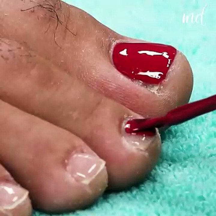 Just about time to get rid of cracked heels🤩