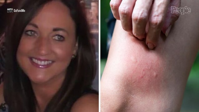 Vacationing Mom Collapses, Falls Down Stairs, Hits Head and Fractures Neck After 'Dozens and Dozens' of Mosquito Bites