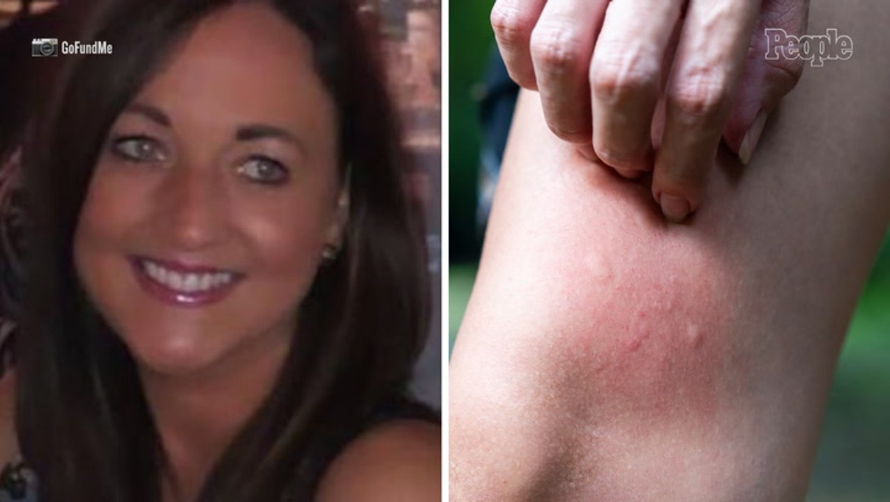 Vacationing Mom Collapses, Falls Down Stairs, Hits Head and Fractures Neck After 'Dozens and Dozens' of Mosquito Bites