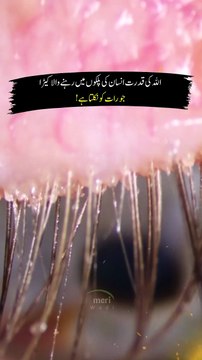 Shocking Discoveries About Insects Living in Human Eyes!