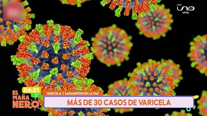 ALERTA POR SARAMPION Y VARICELA